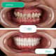 Slider image (10) MBT Dental Pro